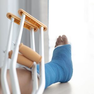 person with a casted leg 